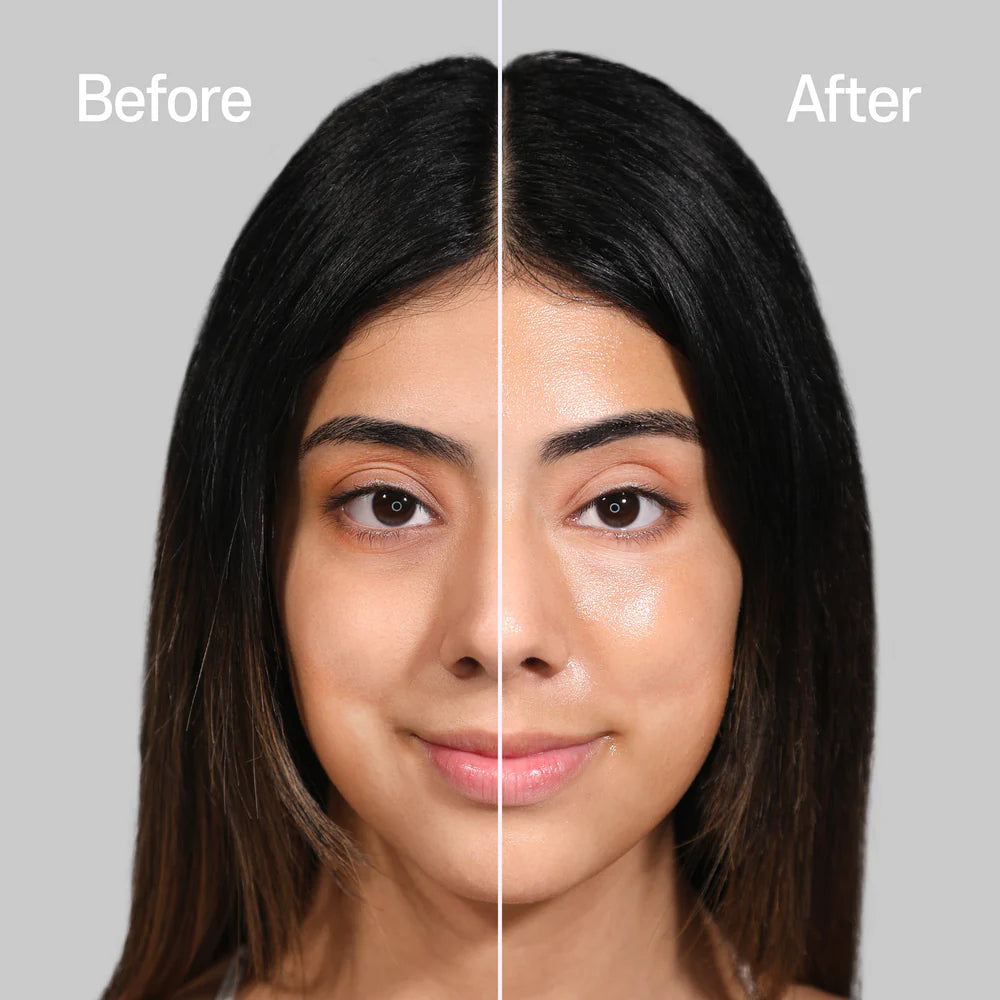 Before and after comparison of a woman's face with a neutral gray background